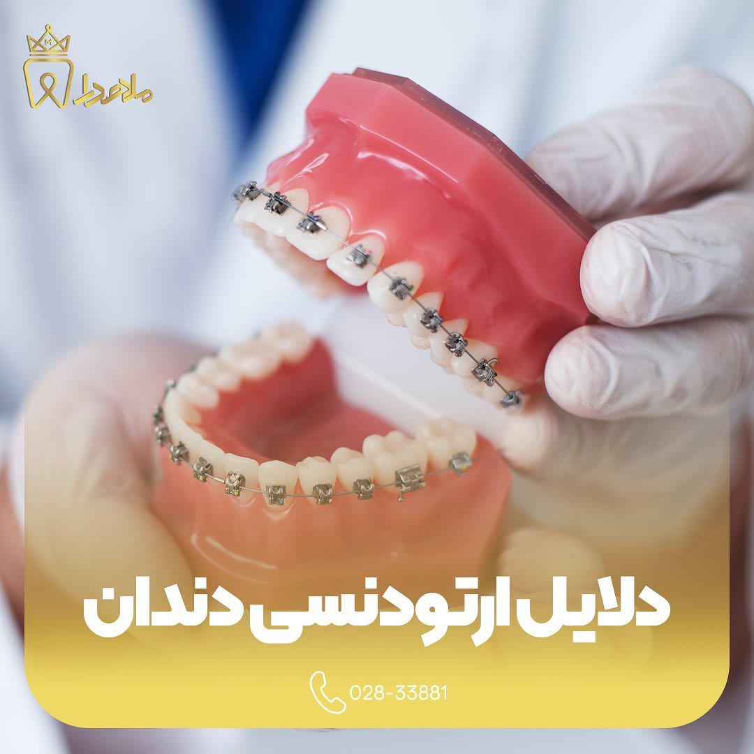 دلایل ارتودنسی دندان